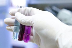 PRP (Platelet Rich Plasma)