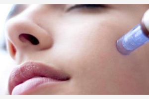 Medical Microneedling